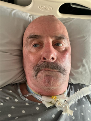 Description of image