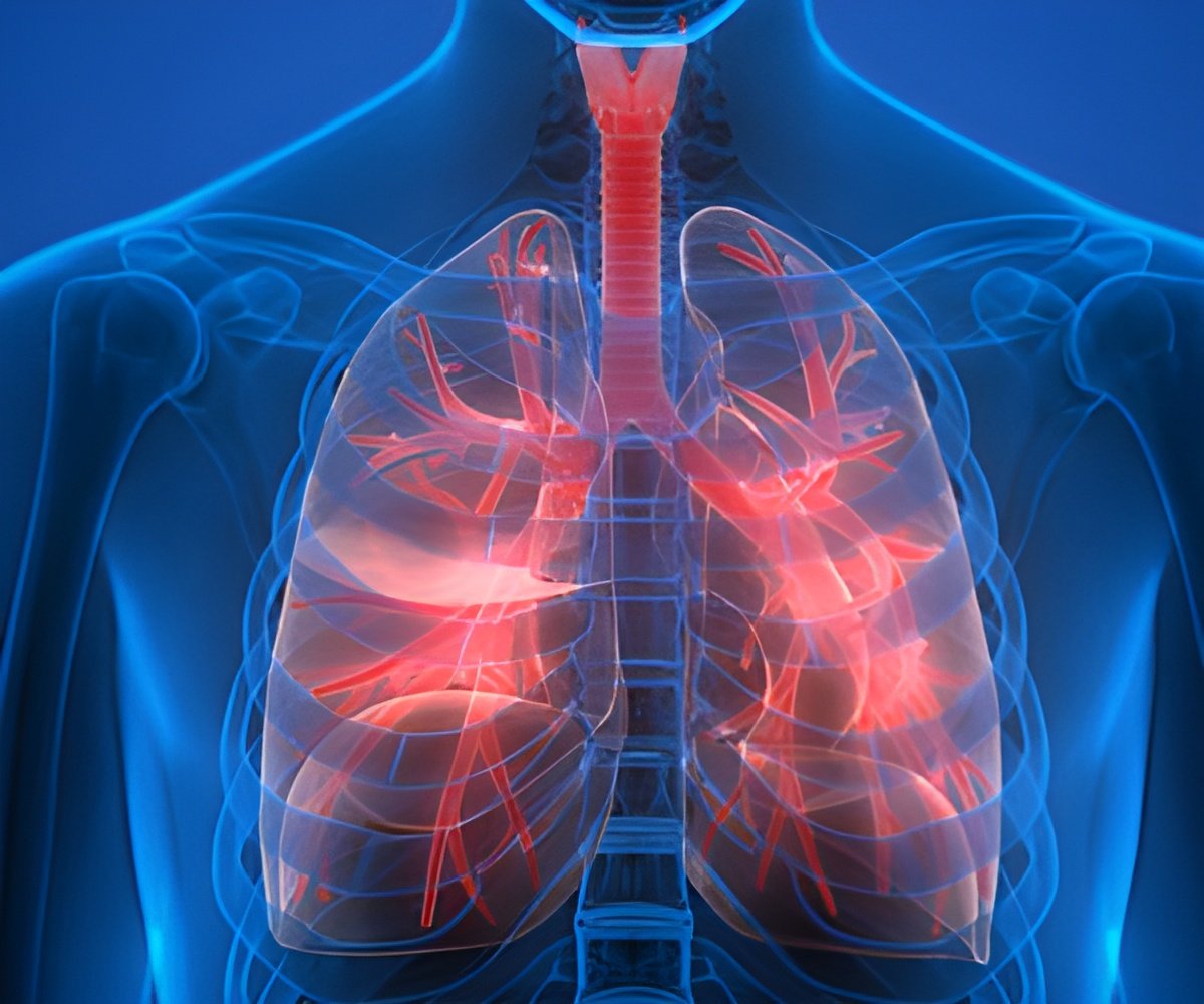 Description of image