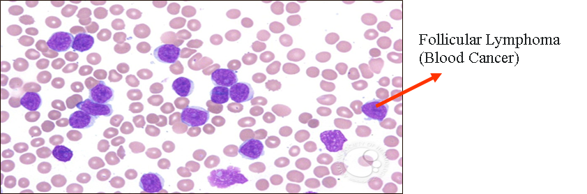 Description of image