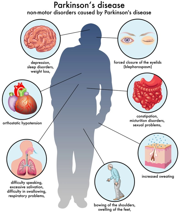 Description of image