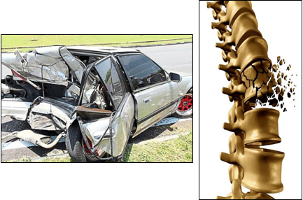 Description of image